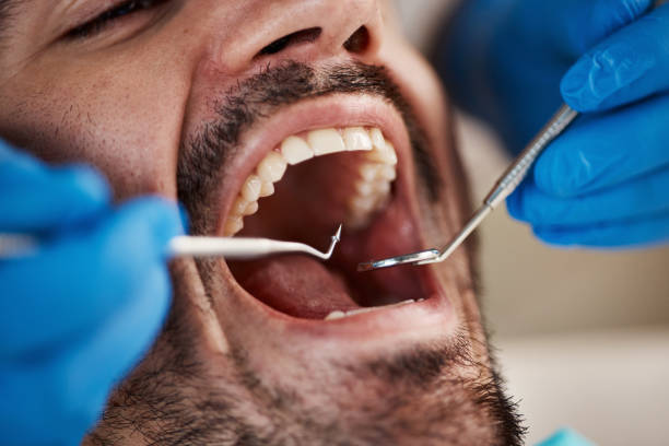 Best Urgent Dental Care  in Mccamey, TX