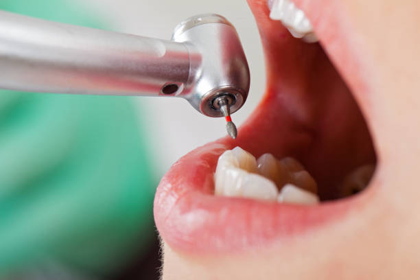 Best Knocked-Out Tooth Emergency  in Mccamey, TX
